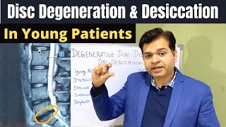 Disc Degeneration L5 S1 Disc Desiccation Disc Degeneration Causes DDDDegenerative Disc Treatment [upl. by Laidlaw]