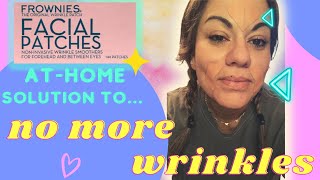 Frownies Review  No More Wrinkles [upl. by Faxan778]