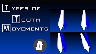 Types Of Tooth Movements  Essential Biomechanics [upl. by Vani]