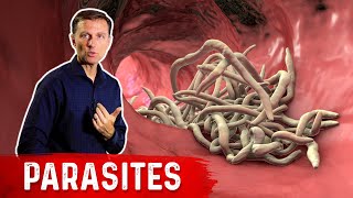 The Best Herbs for Parasites [upl. by Earl]