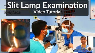 Slit Lamp Exam Tutorial  Part 1 [upl. by Cthrine]