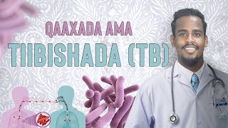 QAAXADA AMA TIIBISHADA TUBELCLOSIS [upl. by Nabe]