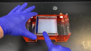 Agarose Gel Electrophoresis [upl. by Kalb951]