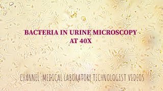 Bacteria under urine microscopy at 40X UTI [upl. by Jessa]