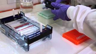 How to run an agarose gel [upl. by Letta]