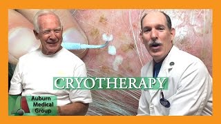 Actinic Keratosis Frozen with Cryotherapy  Auburn Medical Group [upl. by Adnola178]