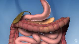 Sleeve Gastrectomy Operation [upl. by Hescock]