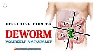 DEWORM NATURALLY An INSIGHT Dr Acsah AB Preventive Measures Food that kills intestinal worms [upl. by Latoye757]