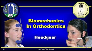 Use of headgear in Orthodontics [upl. by Nonnah879]