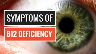 5 Signs and Symptoms of Vitamin B12 Deficiency [upl. by Anitra]