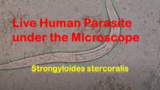 Human Parasites Live under the Microscope  Strongyloides stercoralis [upl. by Corel]