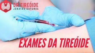 Exames da tireoide  TSH T4 livre Tireoglobulina antitpo  Dr Jônatas Catunda [upl. by Ivz]